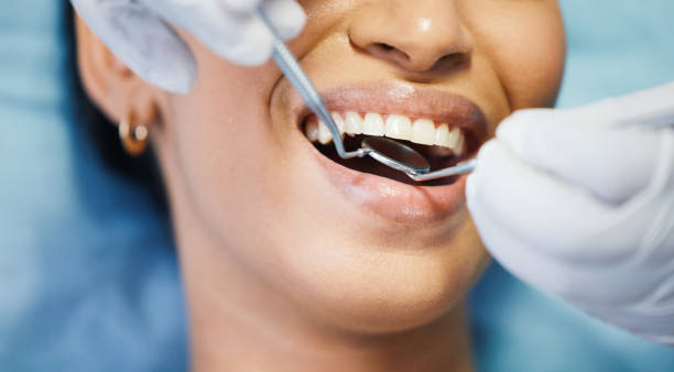 Best Emergency Wisdom Teeth Removal in Roosevelt, NJ
