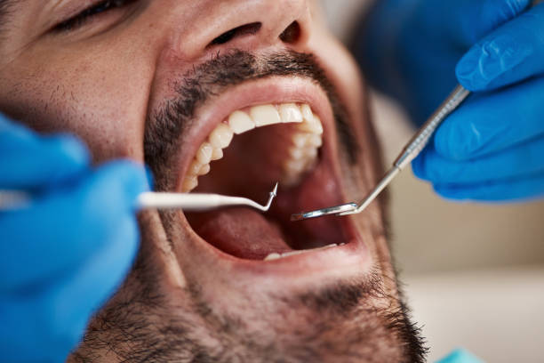 Best Emergency Treatment for Dental Infections or Abscesses in Roosevelt, NJ